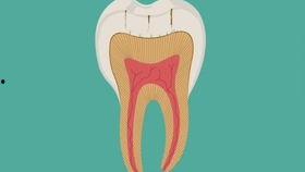 补牙齿视频国产